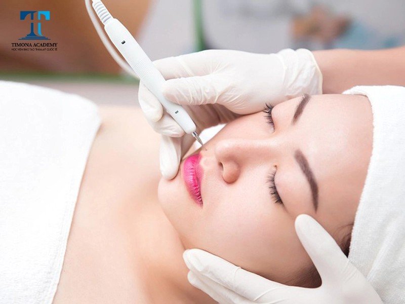 Quy trình sử dụng máy 5 trong 1 để đốt nốt ruồi an toàn tại nhà