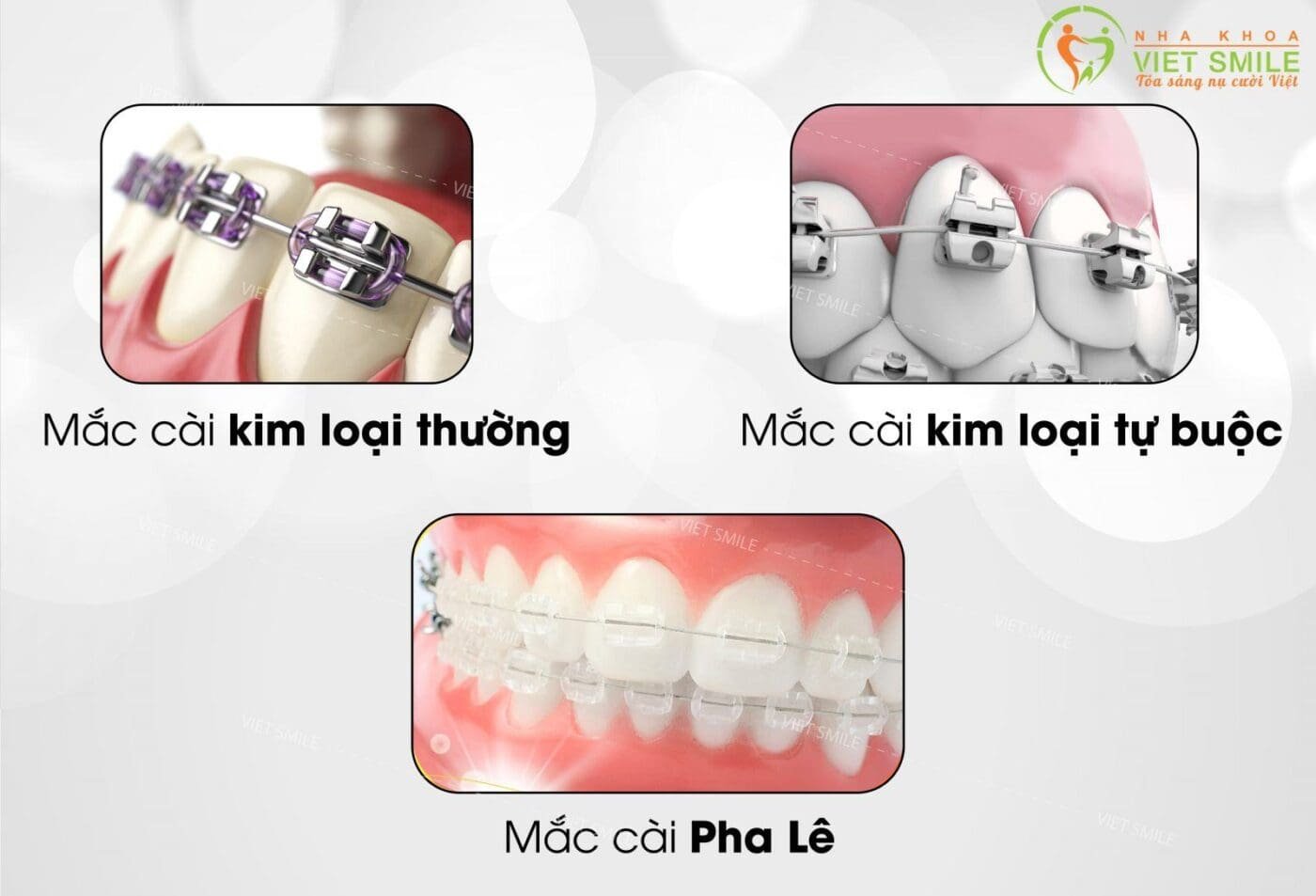 Cài Máy In Qua Cổng LAN Chi Tiết Từ A Đến Z